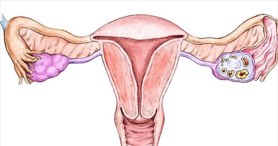 Ποια ποιοτικά κριτήρια πρέπει να πληρεί ο Γυναικολόγος Ογκολόγος που αντιμετωπίζει καρκίνο του ενδομητρίου;